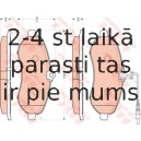 Bremžu uzliku kompl., Disku bremzes TRW GDB1719